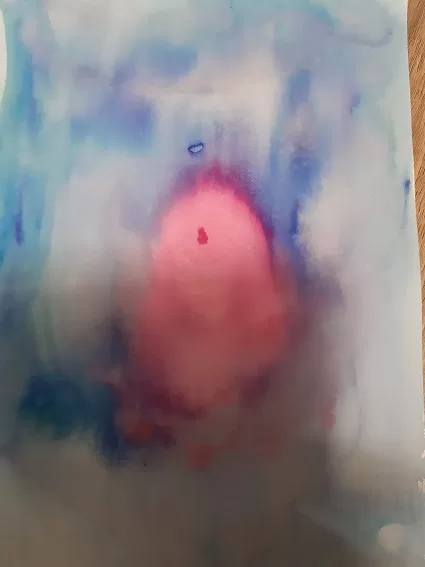 Meine Herzbefreiung